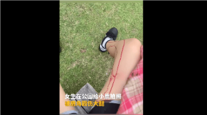 女生探索日本自然美景遭遇小鹿意外戳伤腿，勇敢面对挫折的鼓舞之旅