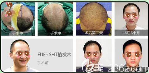 上海整容医院最新排名榜单